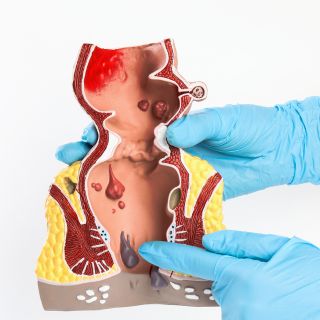 Îmbunătățește sănătatea vasculară